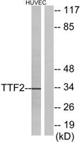 FoxE1 Polyclonal Antibody