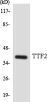 FoxE1 Polyclonal Antibody