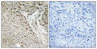 FoxE3 Polyclonal Antibody