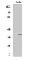 β-1,3-Gal-T1 Polyclonal Antibody