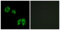 β-1,3-Gal-T2 Polyclonal Antibody