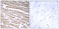 β-1,3-Gal-T2 Polyclonal Antibody