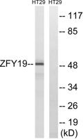 ZFYVE19 Polyclonal Antibody