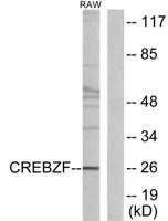 Zhangfei Polyclonal Antibody