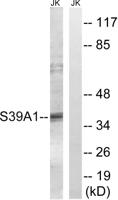 ZIP1 Polyclonal Antibody