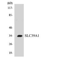 ZIP1 Polyclonal Antibody