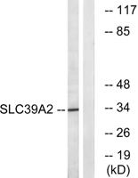 ZIP2 Polyclonal Antibody