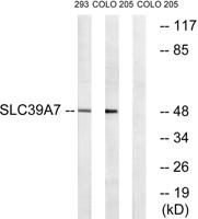 ZIP7 Polyclonal Antibody