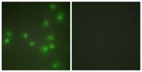 ZIS Polyclonal Antibody