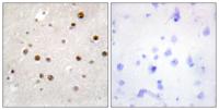 Translin Polyclonal Antibody