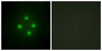 TRAP100 Polyclonal Antibody