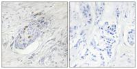 ZNF232 Polyclonal Antibody