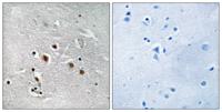 TRAP240 Polyclonal Antibody