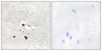 ZNF287 Polyclonal Antibody