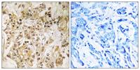 ZNF295 Polyclonal Antibody