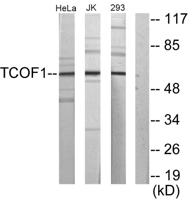 Treacle Polyclonal Antibody