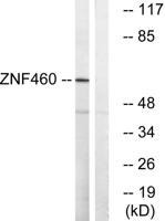 ZNF460 Polyclonal Antibody