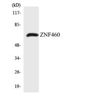 ZNF460 Polyclonal Antibody