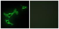 TRIM3 Polyclonal Antibody