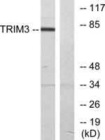 TRIM3 Polyclonal Antibody