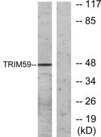 TRIM59 Polyclonal Antibody