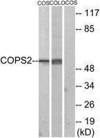 TRIP15 Polyclonal Antibody