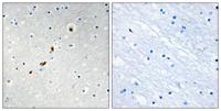 ZNF596 Polyclonal Antibody