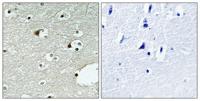 ZNF75 Polyclonal Antibody