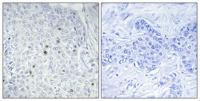 ZNF785 Polyclonal Antibody