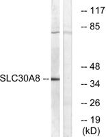 ZnT-8 Polyclonal Antibody