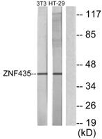 ZSCAN16 Polyclonal Antibody