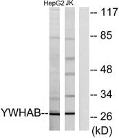 14-3-3 β Polyclonal Antibody