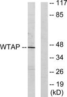 WTAP Polyclonal Antibody