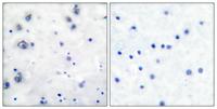 Trk B Polyclonal Antibody