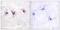 Trk B Polyclonal Antibody