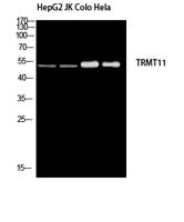 TRMT11 Polyclonal Antibody