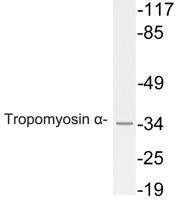 Tropomyosin α Polyclonal Antibody