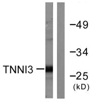 Troponin I-C Polyclonal Antibody