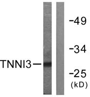 Troponin I-C Polyclonal Antibody