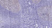 RELT Polyclonal Antibody