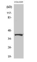 Renin Receptor Polyclonal Antibody