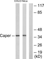 Renin Receptor Polyclonal Antibody