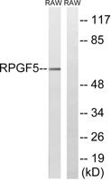 Repac Polyclonal Antibody