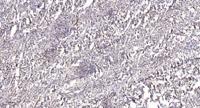 REPS1 Polyclonal Antibody