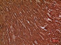 Troponin T-C Polyclonal Antibody