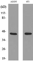 Troponin T-C Polyclonal Antibody