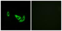 TRP2 Polyclonal Antibody