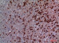 TRPC3 Polyclonal Antibody