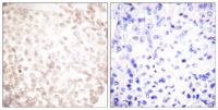 XRCC1 Polyclonal Antibody