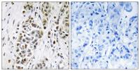 XRN2 Polyclonal Antibody